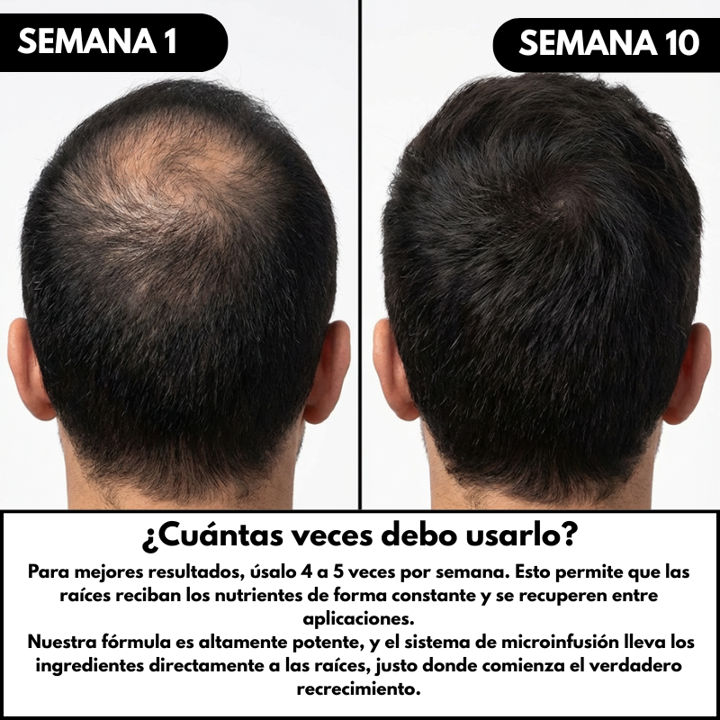 Tratamiento de Recuperación Capilar