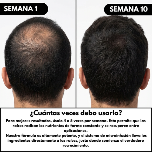 Tratamiento de Recuperación Capilar