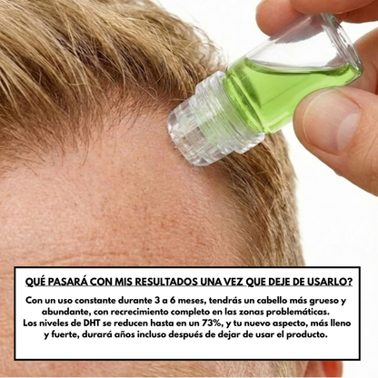 Tratamiento de Recuperación Capilar